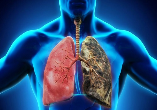 COPD - A Chronic And Serious Respiratory Disorder