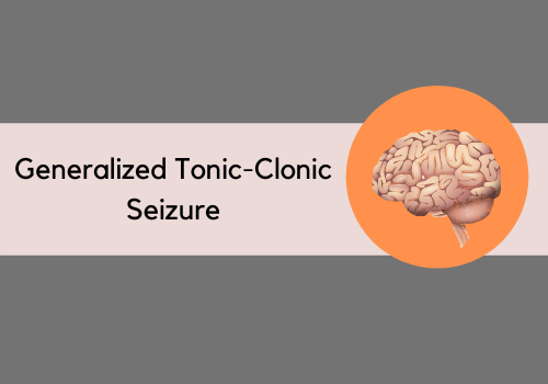 Generalized Tonic-Clonic Seizure