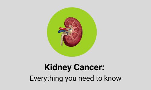 kidney cancer guide