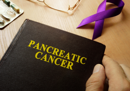 Pancreatic Cancer: Everything You Need To Know