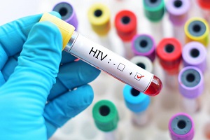 HIV and Herpes Best Treatment- Online Drug Pharmacy